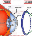 国产人工角膜或今年上半年用于临床 将为中国终末角膜盲患者带去光明